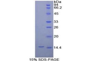 SDS-PAGE (SDS) image for Interleukin 8 (IL8) ELISA Kit (ABIN6730859)