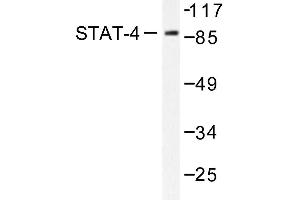 Image no. 2 for anti-Signal Transducer and Activator of Transcription 4 (STAT4) antibody (ABIN271914) (STAT4 anticorps)