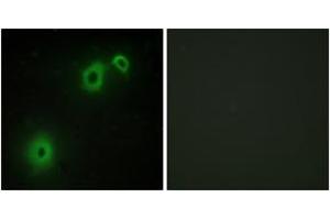 Immunofluorescence (IF) image for anti-Nerve Growth Factor Receptor (NGFR) (AA 121-170) antibody (ABIN2889383) (NGFR anticorps  (AA 121-170))