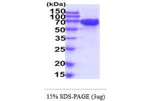 SDS-PAGE (SDS) image for Mast/stem Cell Growth Factor Receptor (KIT) (AA 26-524) protein (His tag) (ABIN5854993) (KIT Protein (AA 26-524) (His tag))