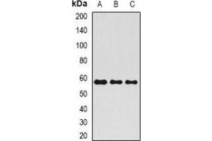 Western blot analysis of ALPP expression in HepG2 (A), rat testis (B), rat liver (C) whole cell lysates. (PLAP anticorps)