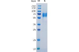 Human IL6R Protein, His Tag on SDS-PAGE under reducing condition. (IL-6 Receptor Protein (AA 20-365) (His tag))