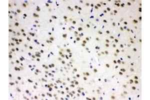 IHC testing of FFPE rat brain with AZIN2 antibody at 1ug/ml. (ADC anticorps)