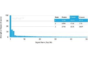 Analysis of Protein Array containing >19,000 full-length human proteins using CD68 Mouse Monoclonal Antibody (C68/2501) Z- and S- Score: The Z-score represents the strength of a signal that a monoclonal antibody (Monoclonal Antibody) (in combination with a fluorescently-tagged anti-IgG secondary antibody) produces when binding to a particular protein on the HuProtTM array. (CD68 anticorps  (AA 150-221))