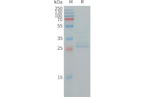 NINJ1 Protein (AA 1-80) (Fc Tag)