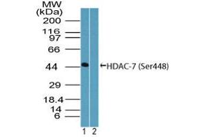 Image no. 1 for anti-Histone Deacetylase 7 (HDAC7) (AA 443-452) antibody (ABIN960196) (HDAC7 anticorps  (AA 443-452))