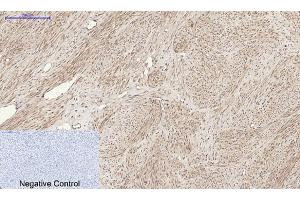 Immunohistochemical analysis of paraffin-embedded human uterus tissue. (RANKL anticorps  (C-Term))