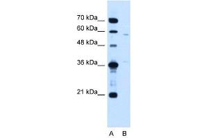 MGC39633 antibody used at 1. (MGC39633 (N-Term) anticorps)