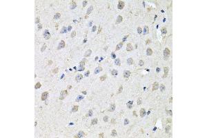 Immunohistochemistry of paraffin-embedded mouse brain using CHCHD3 antibody. (CHCHD3 anticorps  (AA 1-227))