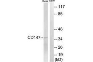 Western blot analysis of extracts from RAW264. (CD147 anticorps  (AA 336-385))