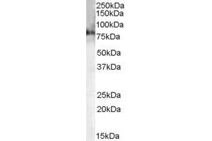 Western Blotting (WB) image for anti-Choline O-Acetyltransferase (CHAT) (AA 629-642) antibody (ABIN299161) (Choline Acetyltransferase anticorps  (AA 629-642))