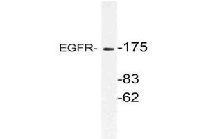 Western blot (WB) analysis of EGFR antibody in extracts from HeLa cells. (EGFR anticorps)