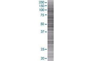 SUSD4 transfected lysate. (SUSD4 293T Cell Transient Overexpression Lysate(Denatured))