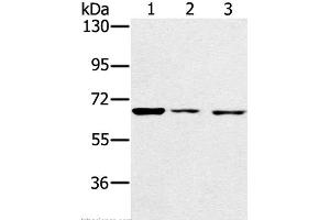 Western Blot analysis of A172, hela and hepg2 cell using IGF2BP3 Polyclonal Antibody at dilution of 1:200 (IGF2BP3 anticorps)