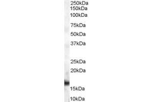 Western Blotting (WB) image for anti-Dachshund 2 (DACH2) (C-Term) antibody (ABIN2156671) (DACH2 anticorps  (C-Term))