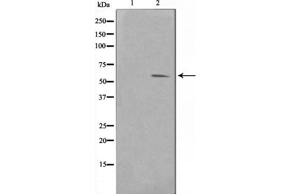 PIM1 anticorps  (Internal Region)