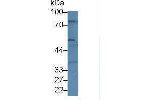 Western blot analysis of Human U87-MG cell lysate, using Human BEST1 Antibody (1 µg/ml) and HRP-conjugated Goat Anti-Rabbit antibody ( (Bestrophin 1 anticorps  (AA 292-585))