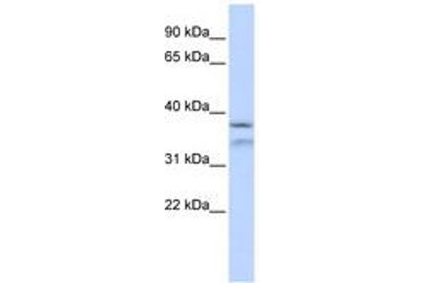 HYLS1 anticorps  (AA 216-265)