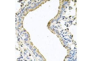 Immunohistochemistry of paraffin-embedded mouse lung using CHCHD3 antibody. (CHCHD3 anticorps  (AA 1-227))