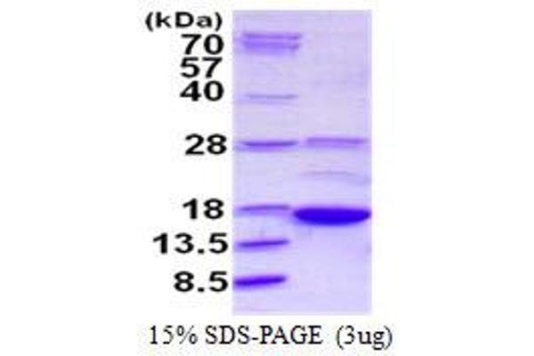 AKAP7 Protein (His tag)