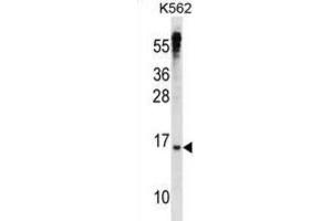 Western Blotting (WB) image for anti-MAX Dimerization Protein 3 (MXD3) antibody (ABIN2998538) (MXD3 anticorps)