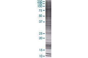 RNF12 transfected lysate. (RNF12 293T Cell Transient Overexpression Lysate(Denatured))