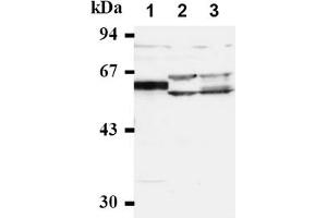 Western Blotting (WB) image for anti-Cell Division Cycle 25 Homolog A (S. Pombe) (CDC25A) antibody (ABIN487483) (CDC25A anticorps)