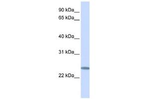 C12ORF49 antibody used at 1 ug/ml to detect target protein. (C12orf49 anticorps  (C-Term))