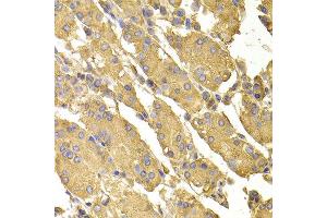 Immunohistochemistry of paraffin-embedded human stomach using PPP2CA antibody at dilution of 1:100 (x400 lens). (PPP2CA anticorps)