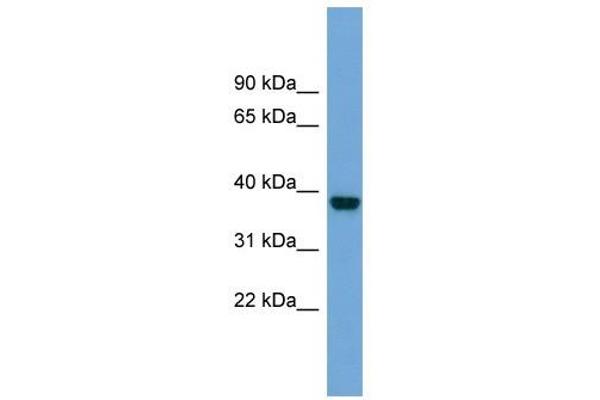 ATP1B4 anticorps