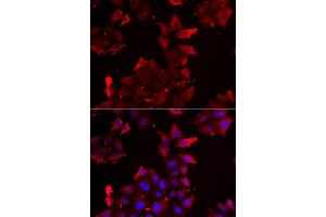 Immunofluorescence analysis of U2OS cells using PDLIM1 antibody. (PDLIM1 anticorps)