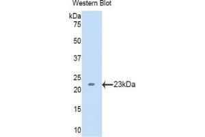 WB of Protein Standard: different control antibodies against Highly purified E. (LCAT Kit ELISA)