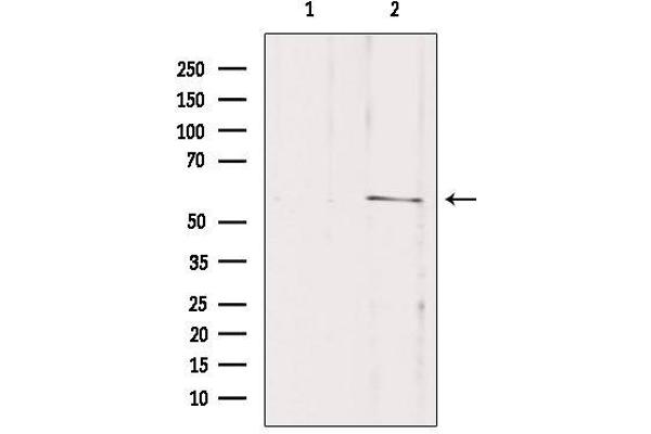 SLC16A2/MCT8 anticorps  (Internal Region)