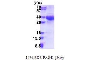 SDS-PAGE (SDS) image for Exosome Component 8 (EXOSC8) (AA 1-276) protein (His tag) (ABIN5853637) (EXOSC8 Protein (AA 1-276) (His tag))