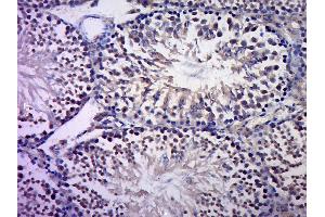 Immunohistochemistry (Paraffin-embedded Sections) (IHC (p)) image for anti-Jun Proto-Oncogene (JUN) (AA 31-331) antibody (ABIN671691)