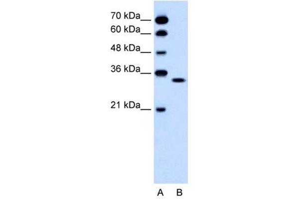 OR5T2 anticorps  (C-Term)