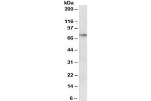 Western blot testing of human heart lysate with p63 antibody at 0. (TCP1 alpha/CCTA anticorps)