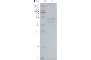 Human C5AR1-Nanodisc, Flag Tag on SDS-PAGE (C5AR1 Protéine)