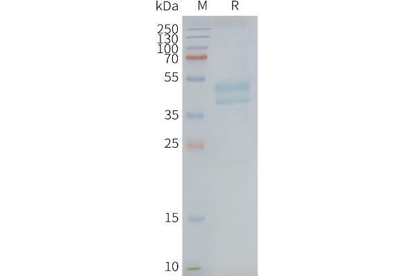 C5AR1 Protéine