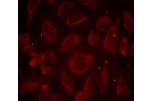 Immunofluorescence staining of methanol-fixed HeLa cells using NF-κB p65 (phospho-Ser468) antibody (E011013, Red) (NF-kB p65 anticorps  (pSer468))