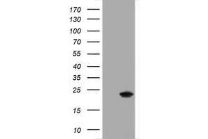 Western Blotting (WB) image for anti-Crystallin, alpha A (CRYAA) antibody (ABIN2715977) (CRYAA anticorps)