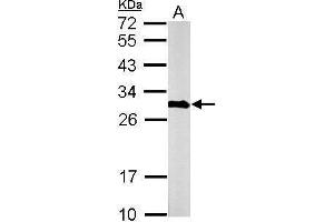 Western Blotting (WB) image for anti-Calbindin 2 (CALB2) antibody (ABIN2855596)