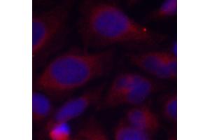 Immunofluorescence staining of methanol-fixed HeLa cells using Phospho-NFKB1-S893 antibody (ABIN2988205). (NFKB1 anticorps  (pSer893))