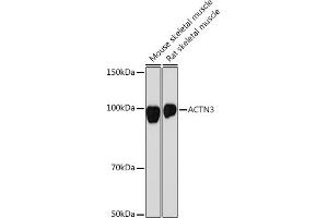 Western blot analysis of extracts of various cell lines, using  Rabbit mAb (ABIN7265398) at 1:1000 dilution. (ACTN3 anticorps)