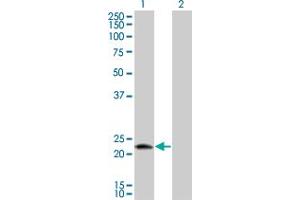 Western Blot analysis of LOC51136 expression in transfected 293T cell line by LOC51136 monoclonal antibody (M01), clone 4H7. (RNFT1 anticorps  (AA 1-100))