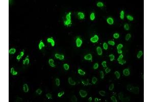 Immunofluorescence staining of Hela cells (treated with 30mM sodium butyrate for 4h) with ABIN7139180 at 1:7. (HIST1H3A anticorps  (acLys37))