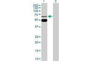 Western Blot analysis of MEF2C expression in transfected 293T cell line by MEF2C MaxPab polyclonal antibody. (MEF2C anticorps  (AA 1-469))