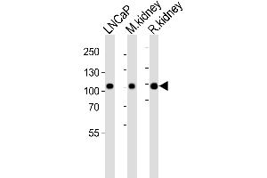 Western blot analysis of lysates from LNCaP cell line, mouse kidney, rat kidney tissue lysate(from left to right), using E Antibody (Center) (ABIN6243088 and ABIN6577473). (MME anticorps  (AA 492-525))