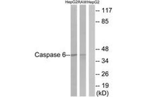 Western Blotting (WB) image for anti-Caspase 6, Apoptosis-Related Cysteine Peptidase (CASP6) (AA 223-272) antibody (ABIN2888590) (Caspase 6 anticorps  (AA 223-272))