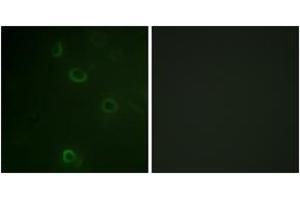 Immunofluorescence analysis of COS7 cells, using ATPase (Ab-16) Antibody. (ATPase anticorps  (AA 5-54))